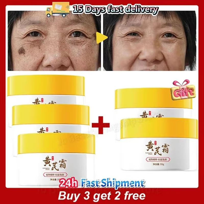 Astragalus Whitening Freckles Cream Face Dark Spots Remover Repair Products Removal Melasma Melanin Moisturiz Brighten Skin Care