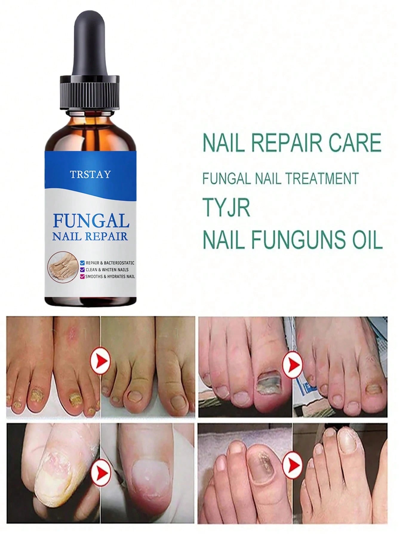 Nail Care Essence with Natural Ingredients to Improve the Appearance of Nails and Keep Them in Good Condition