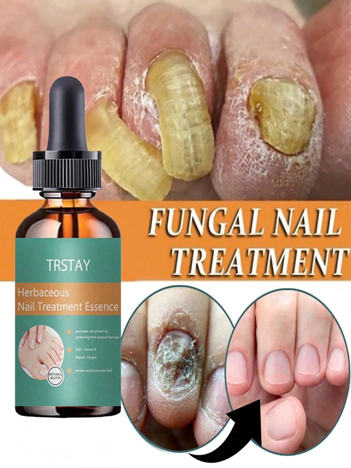 Nail Care Solution with Coconut Scent, Nail Protection Hydrates Nails and Nourishes Our Nails