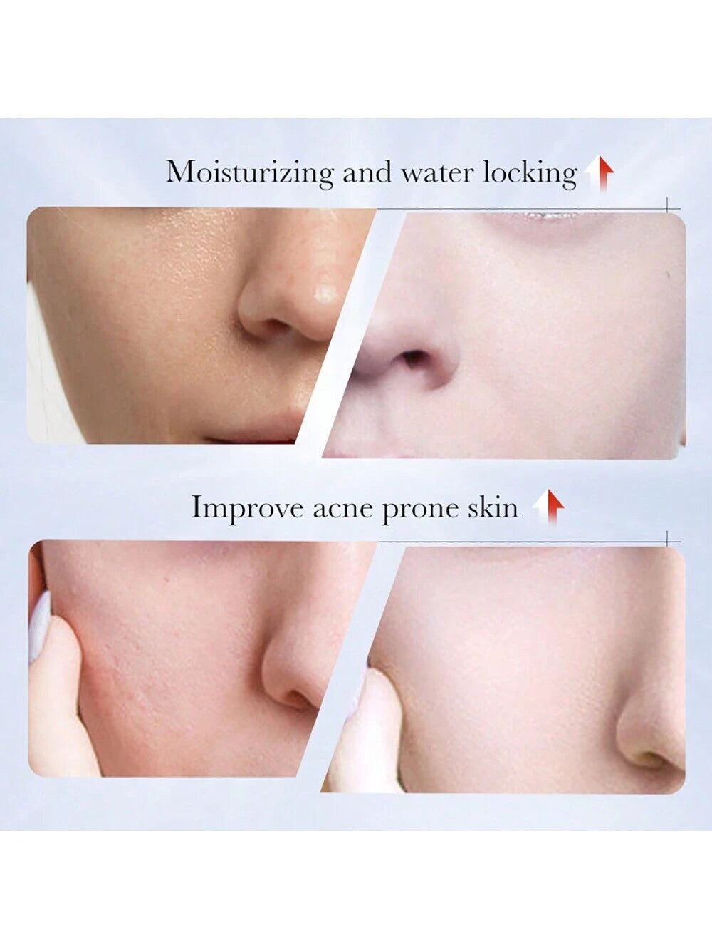 Whitening and Anti-Freckle Cream, Spot Removal, Moisturizing and Whitening Cream for Men and Women