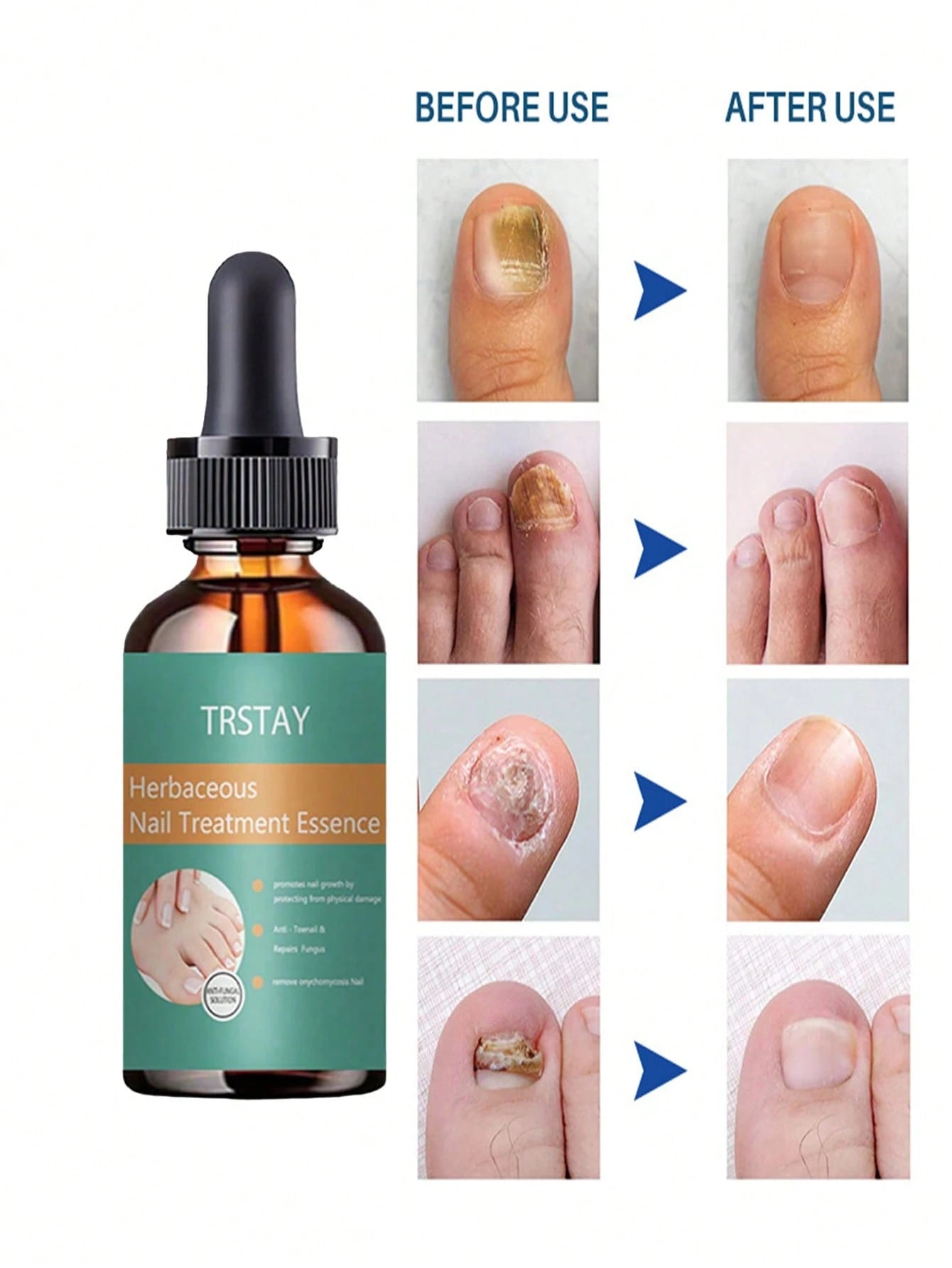 Nail Care Solution with Coconut Scent, Nail Protection Hydrates Nails and Nourishes Our Nails