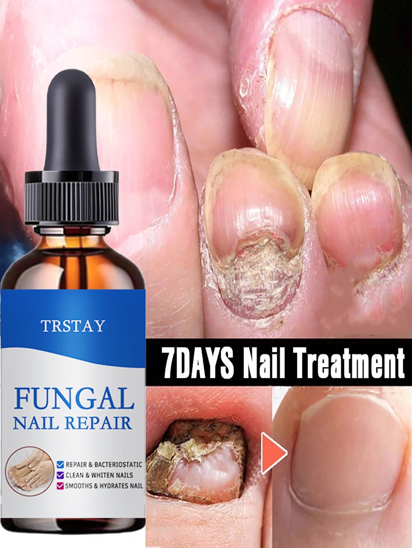 Nail Care Essence with Natural Ingredients to Improve the Appearance of Nails and Keep Them in Good Condition