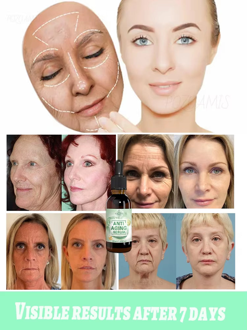 Wrinkles Disappear, the First Choice for Beauty Lovers