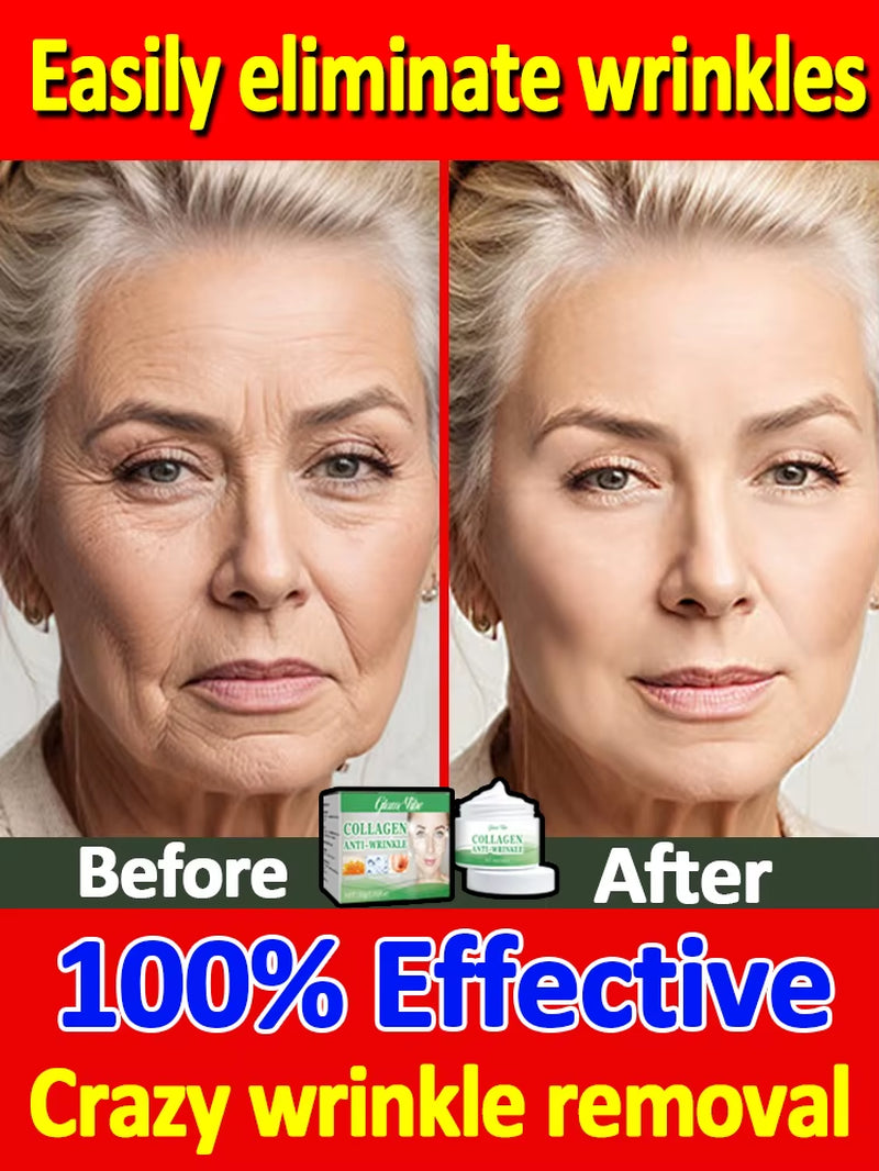 Wrinkles Disappear Become Beautiful Now