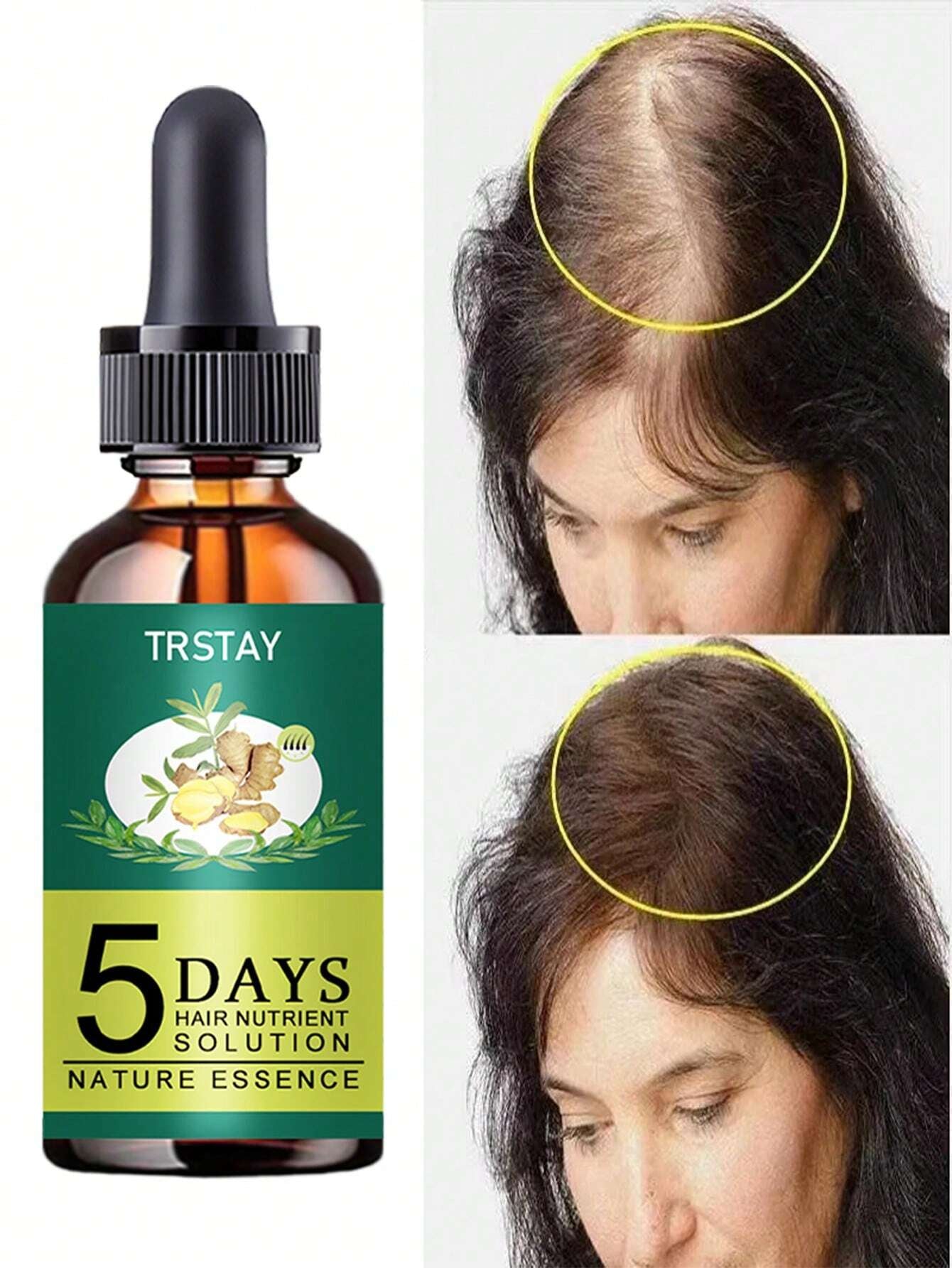 Hair Essence Oil 5 Natural Ginger Hair Oil anti Hair Loss Prevention Baldness Treatment Quick Nourishing Scalp Hair Care