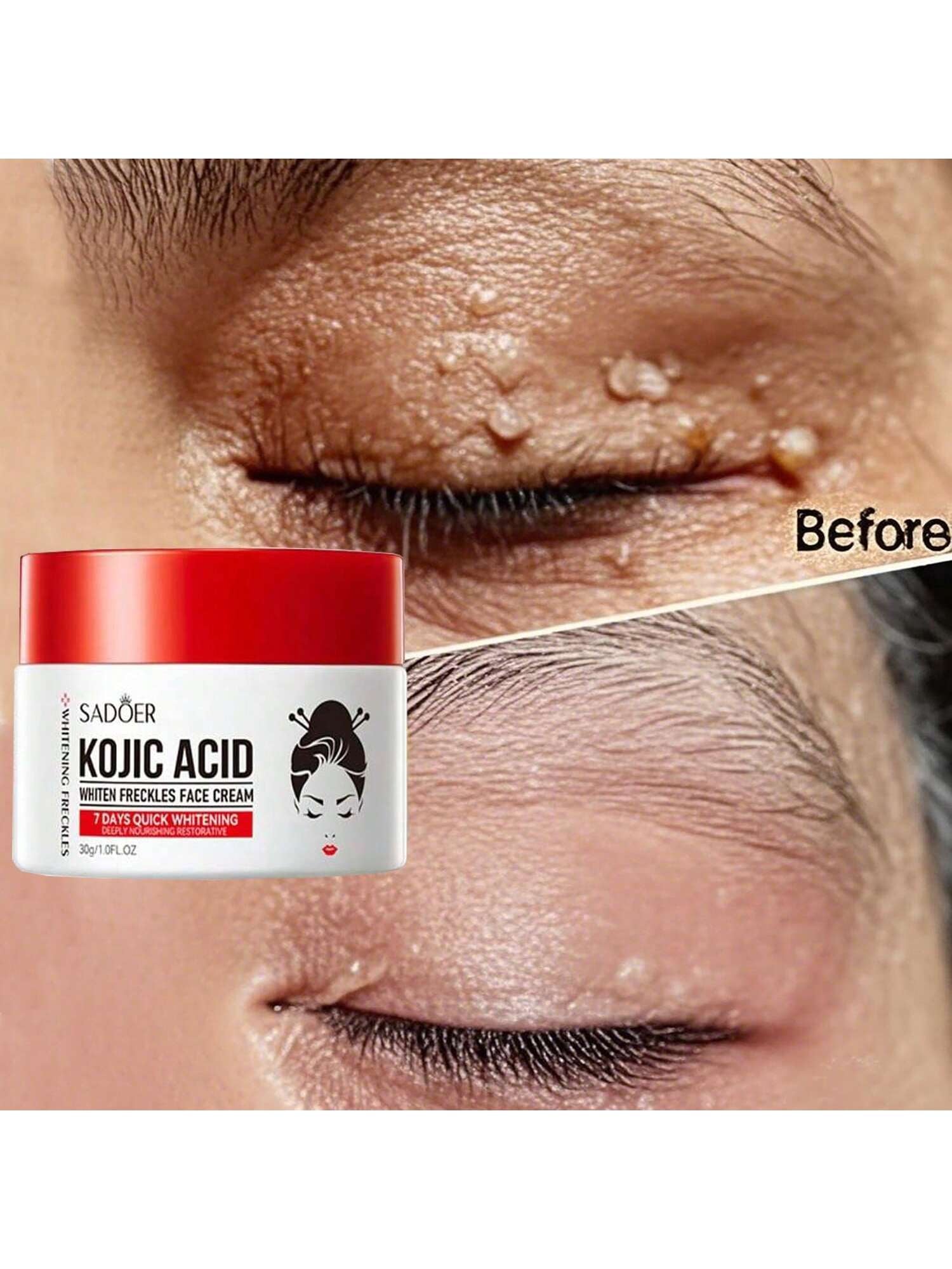 Whitening and Anti-Freckle Cream, Spot Removal, Moisturizing and Whitening Cream for Men and Women