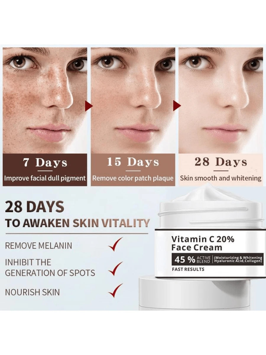 Effective Whitening Freckle Cream Remove Melasma Acne Spot Pigment Dark Spots Pigmentation Moisturizer Skin Care Face Essence Facial Serum