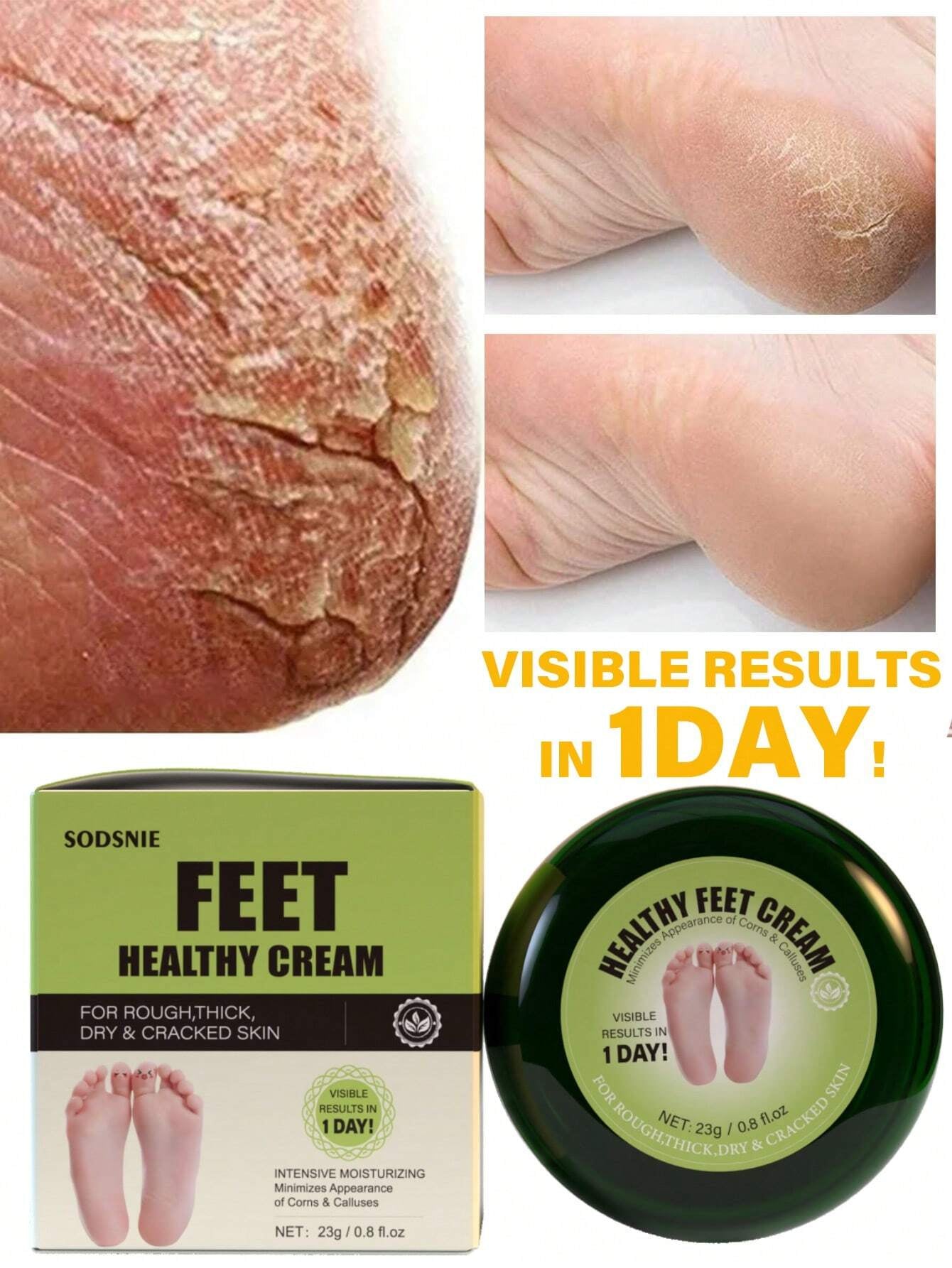 23G Foot Health Cream, Anti-Crack & Exfoliating, Deep Moisturizing & Dryness Relief, Improves Rough Skin, Foot Care