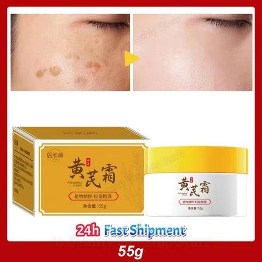 Astragalus Whitening Freckles Cream Face Dark Spots Remover Repair Products Removal Melasma Melanin Moisturiz Brighten Skin Care