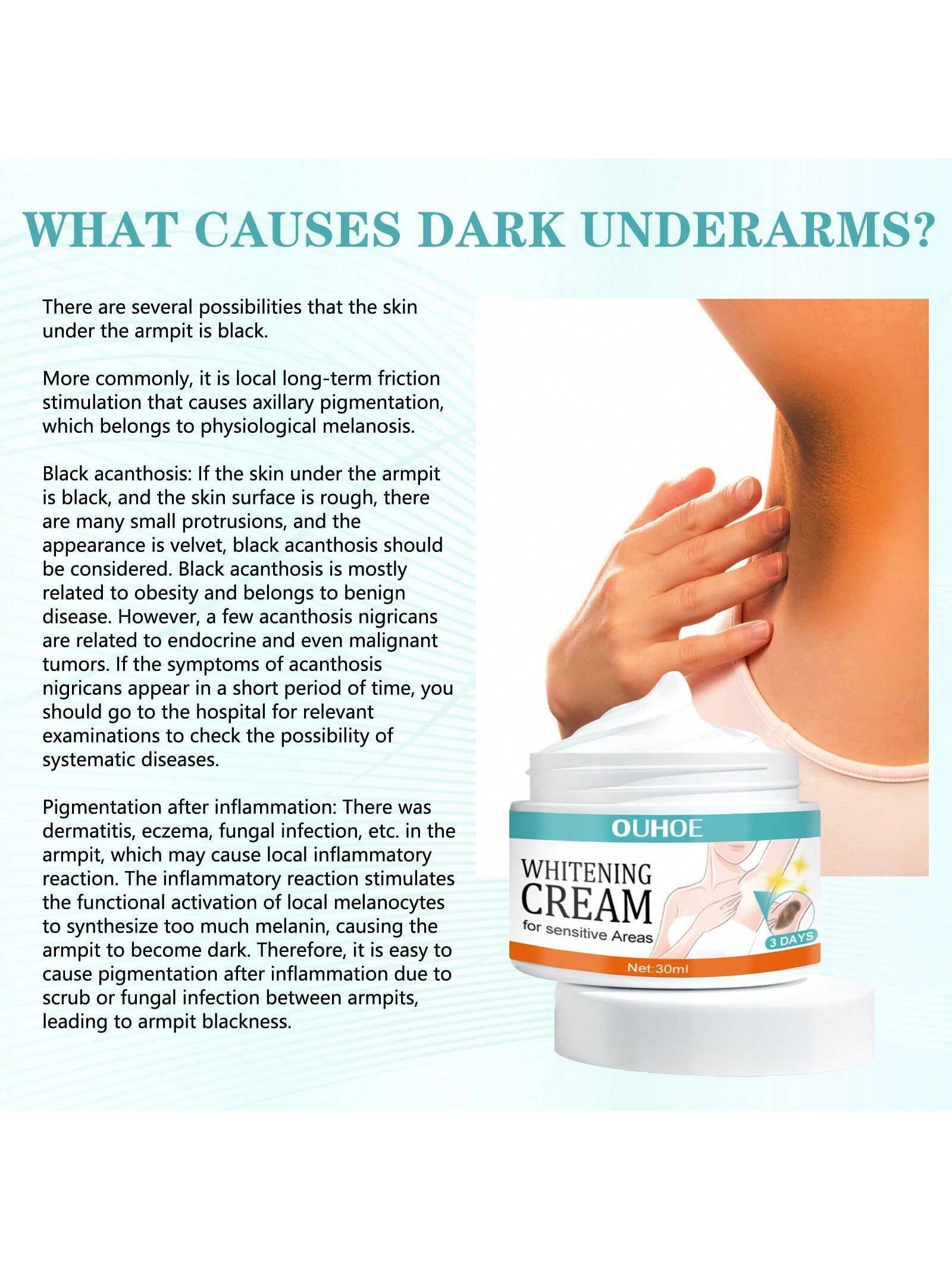 30Ml Underarm Whitening Cream Lighten Underarm Joints Elbow Hydrating Skin Brightening Cream