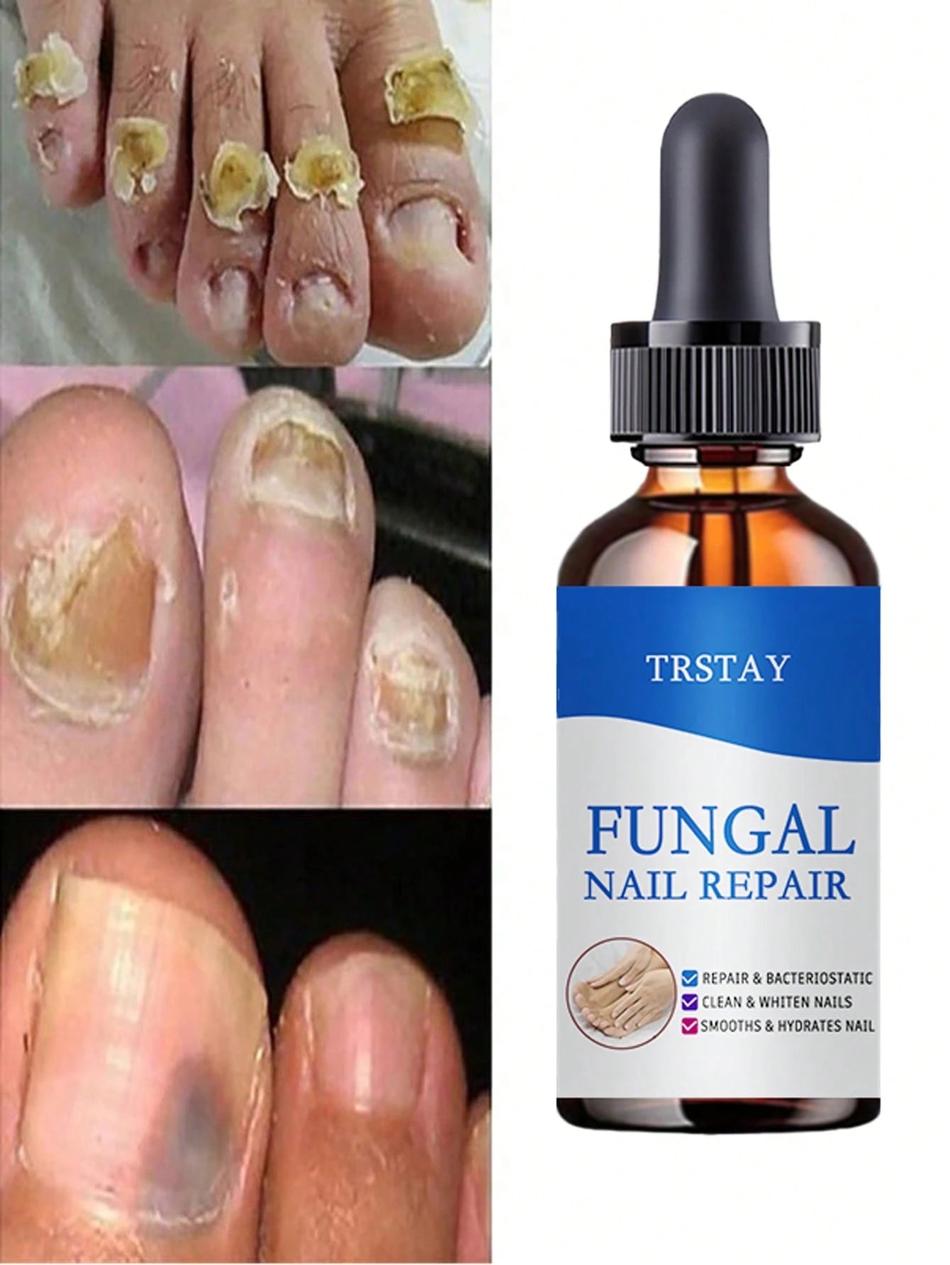 Nail Care Essence with Natural Ingredients to Improve the Appearance of Nails and Keep Them in Good Condition