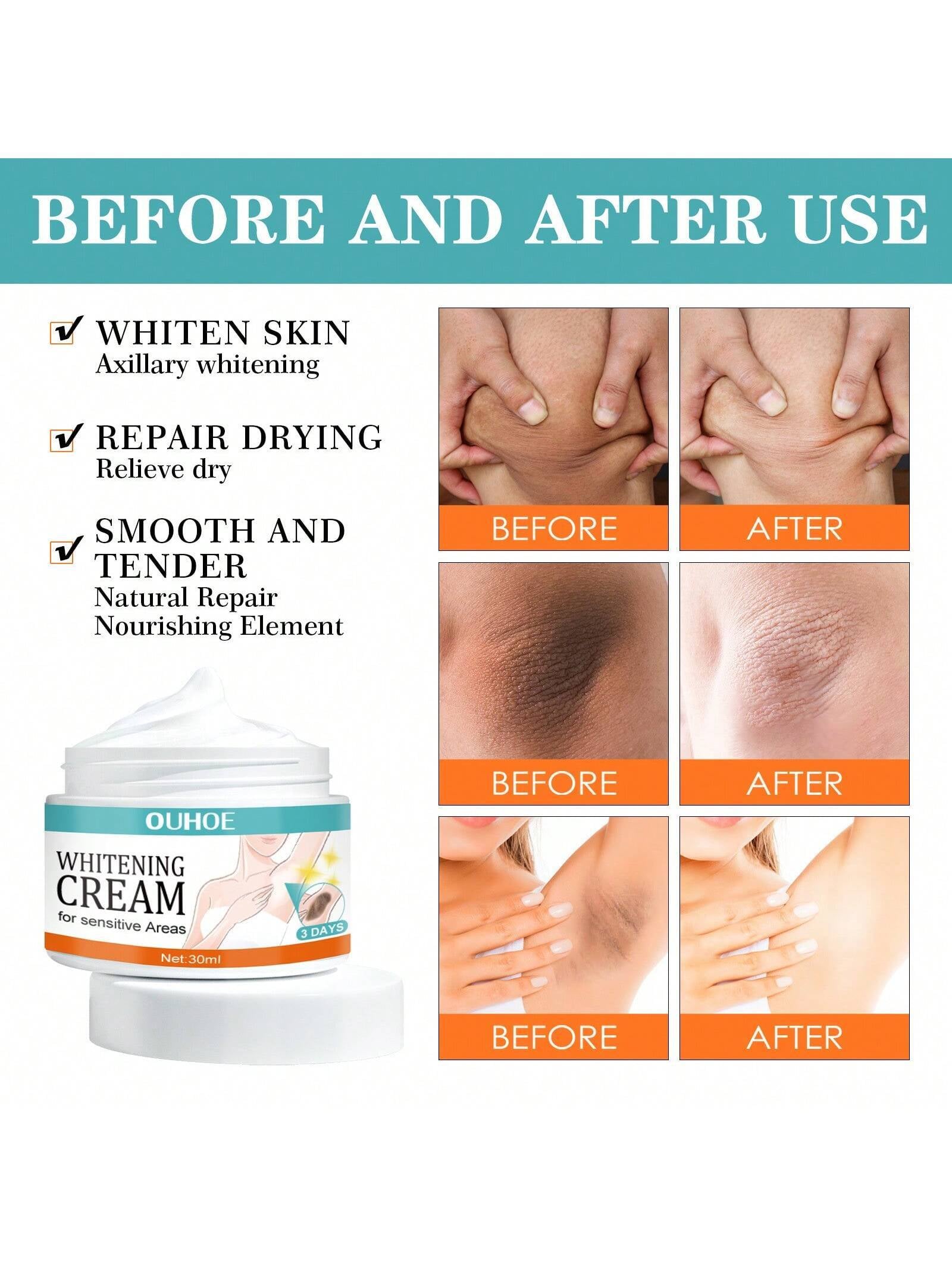 30Ml Underarm Whitening Cream Lighten Underarm Joints Elbow Hydrating Skin Brightening Cream