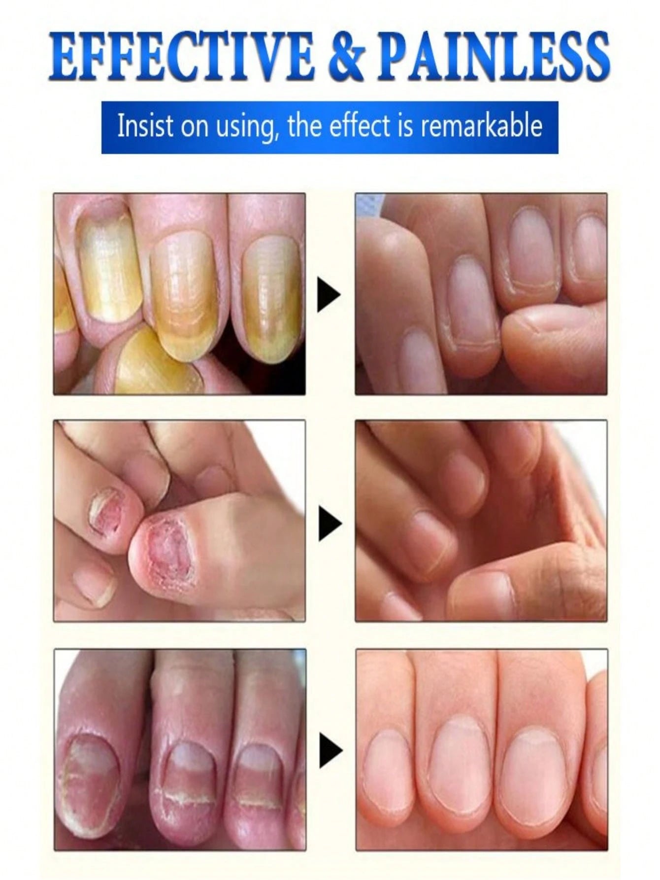 Nail Care Essence with Natural Ingredients to Improve the Appearance of Nails and Keep Them in Good Condition