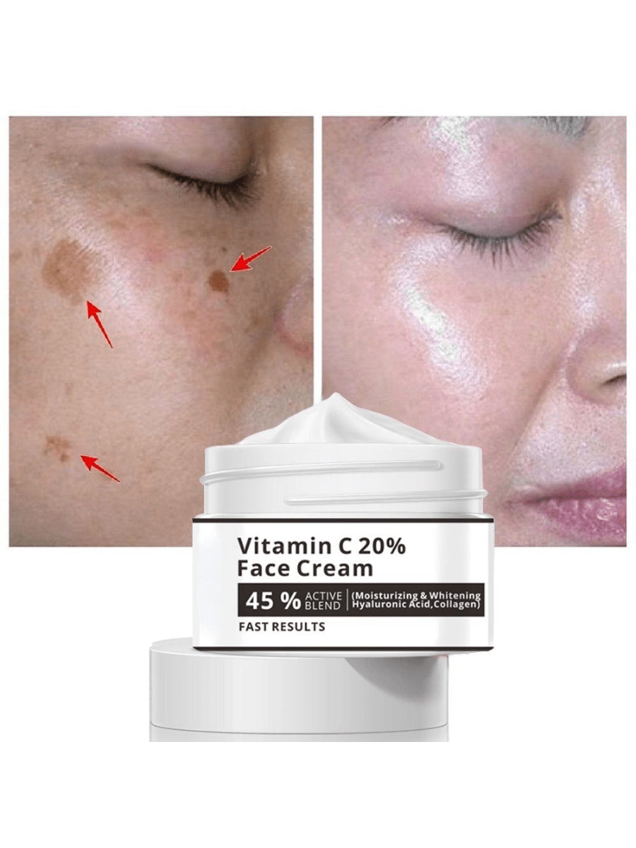 Effective Whitening Freckle Cream Remove Melasma Acne Spot Pigment Dark Spots Pigmentation Moisturizer Skin Care Face Essence Facial Serum